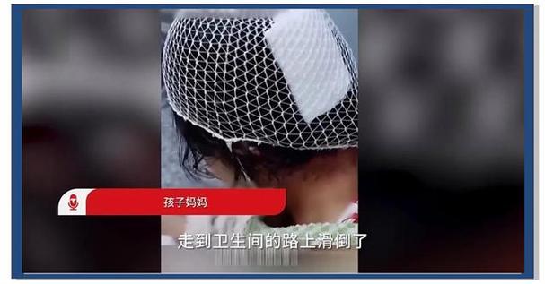 戴鲨鱼夹摔倒致骨折？鲨鱼夹引发摔倒事故，骨折风险需警惕