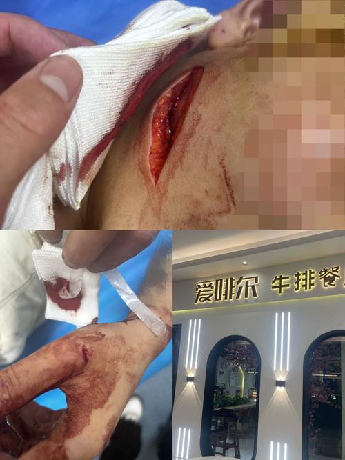 男子持菜刀砍伤同学？男子持刀砍伤同学事件报道