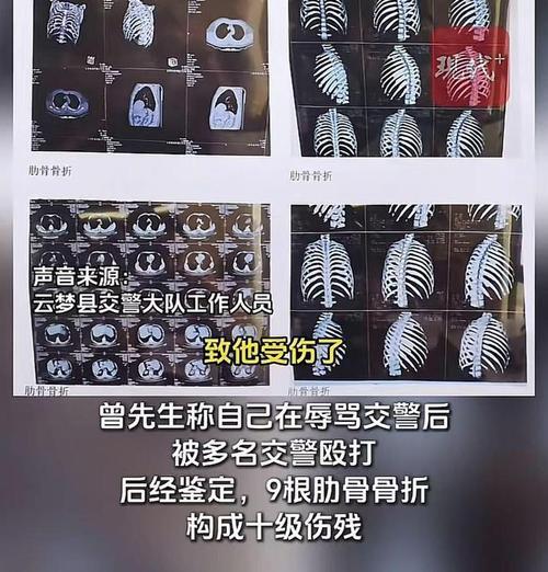 辱骂交警被打断肋骨？辱骂交警遭暴力反击，肋骨断裂事件曝光