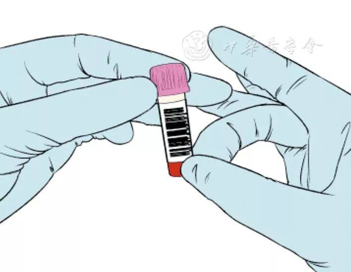 采血备案和有案底的区别