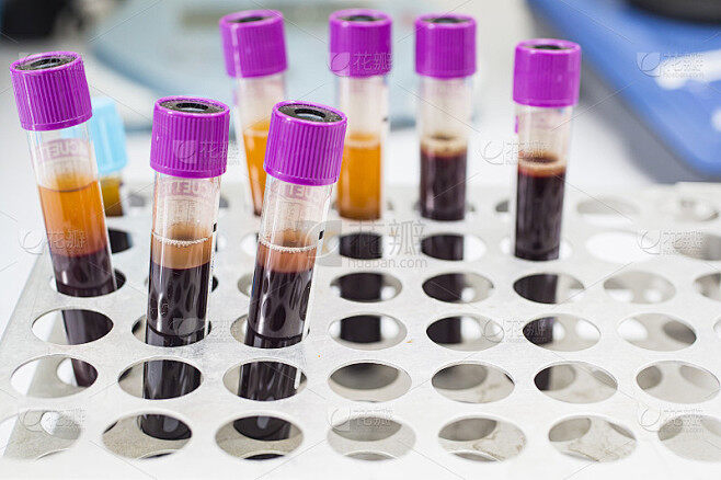 采血管需要在医保中心备案吗