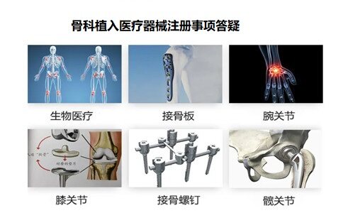 骨折需要去备案吗