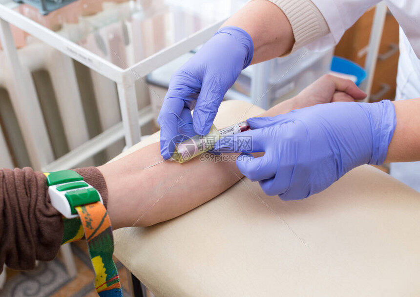 采血备案和有案底的区别