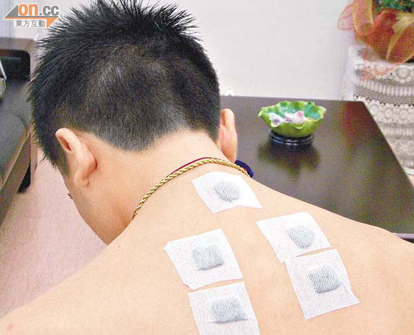 敷贴需要备案吗