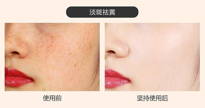 祛斑内服药怎么查备案